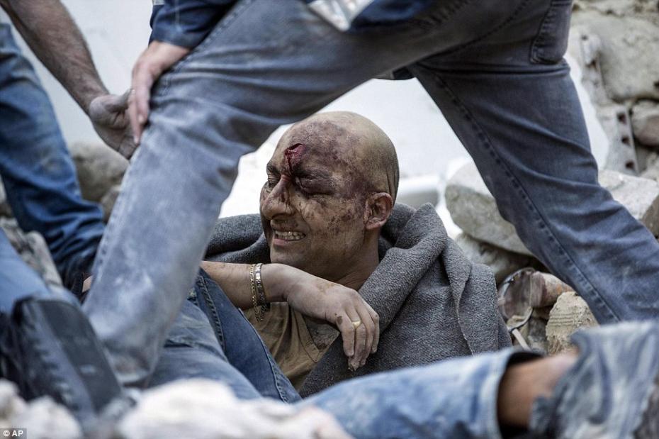 37897FC300000578-3755722-Agony_A_man_is_pulled_out_of_the_rubble_with_a_large_gash_in_his-a-2_1472026853526