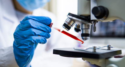 Scientist working with blood sample in laboratory