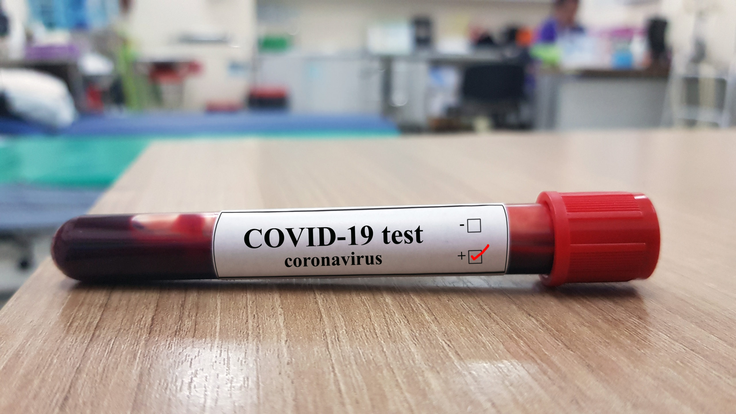 (grafic) Câte teste COVID-19 au fost efectuate în Moldova în perioada 2 martie-6 aprilie 2020